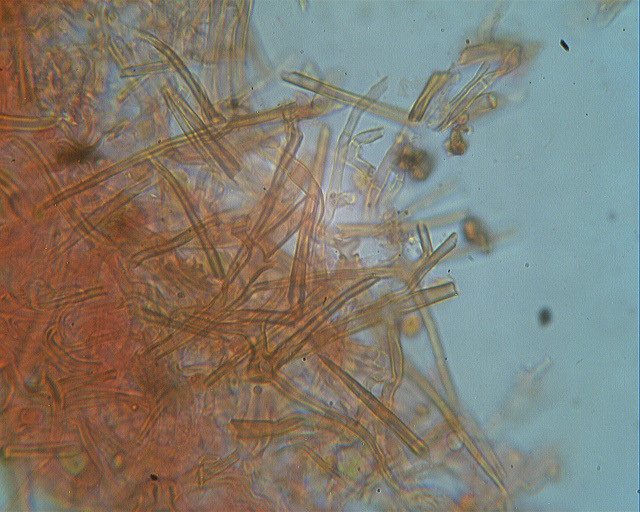 Asterostroma laxum Bres. (1920)